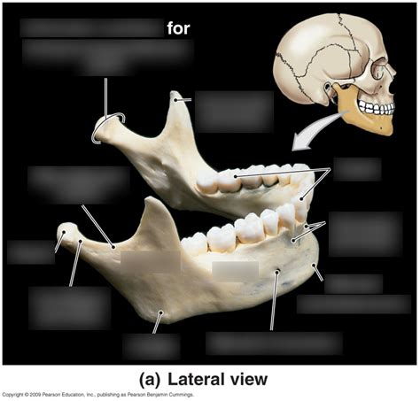 Mandible Diagram | Quizlet