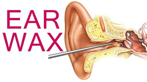 Ear Wax Removal | Safe Ear Wax Removal For Improved Ear Health