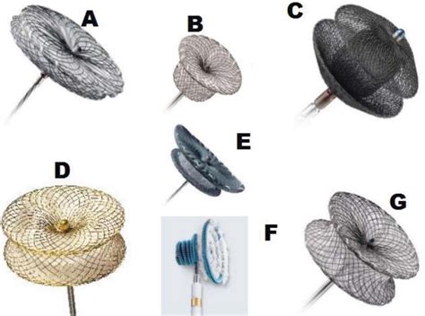 Transcatheter Closure of Congenital VSDs: Tips and Tricks | IntechOpen