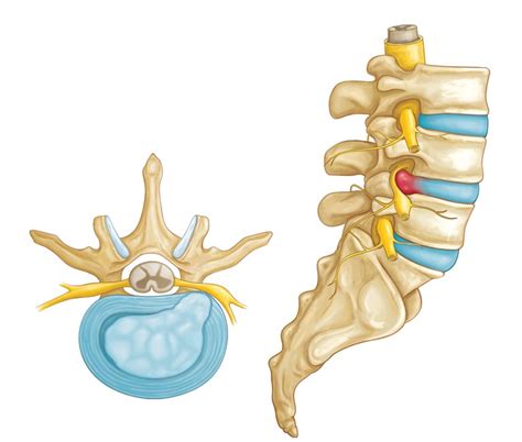 Neck & Back Doctors | Midwest Bone & Joint Center