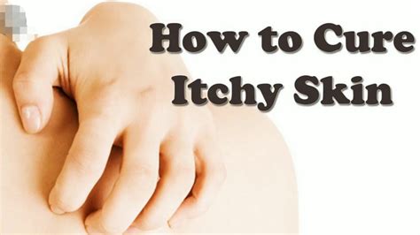 How To Get Rid Of Itchy And Irritated Skin | How To Cure Itchy skin | Home Remedies | Stop Itchy ...