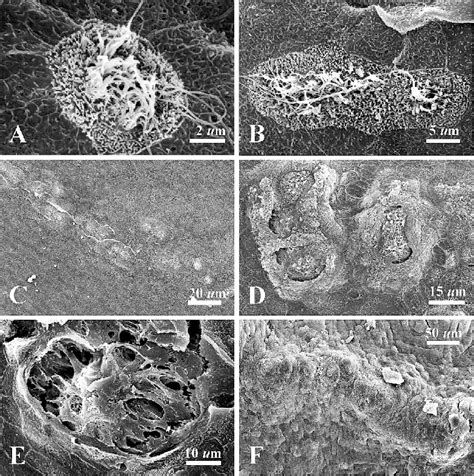 Scanning electron micrograph of neuromasts and stitches in Pseudis... | Download Scientific Diagram