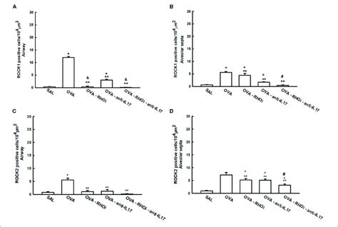 | Effects of ROCK inhibitor and anti-IL17 in cells involved in ...