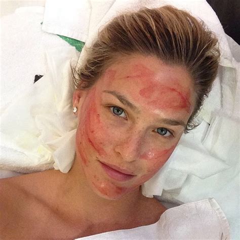 Bar Refaeli gets vampire facelift | The Times of Israel