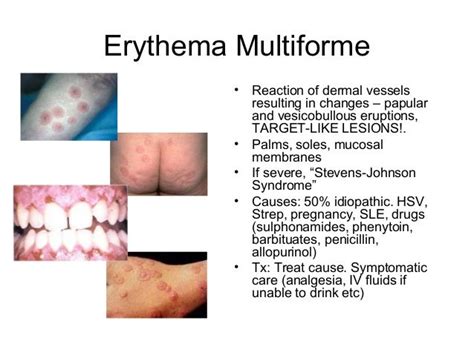 Dermatology Atlas