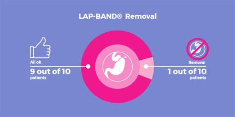 LAP-BAND® Problems and Complications - Complete List - Bariatric Surgery Source