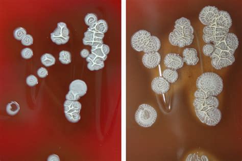 Morphology of colonies on Columbia blood agar after 24 h (left) and... | Download Scientific Diagram