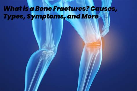 What is a Bone Fracture? - Causes, Types, Symptoms, and More