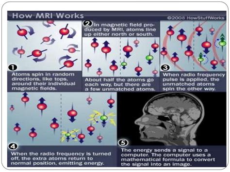 Mri basic principle and sequences