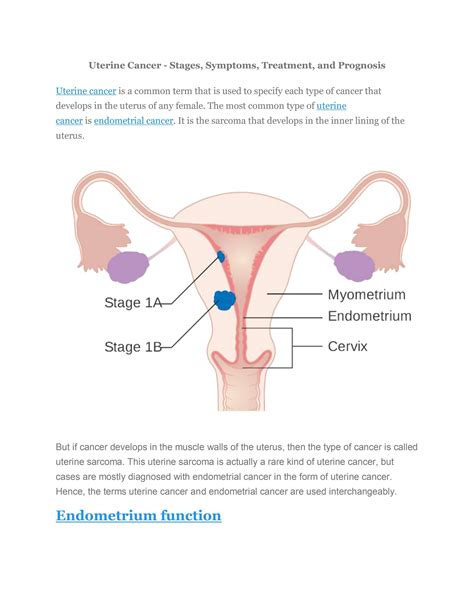 Uterine Cancer - Stages, Symptoms, Treatment, and Prognosis by ...