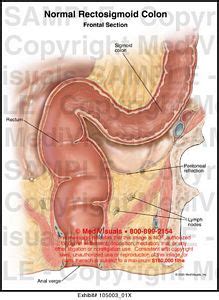 Medivisuals Normal Rectosigmoid Colon Medical Illustration