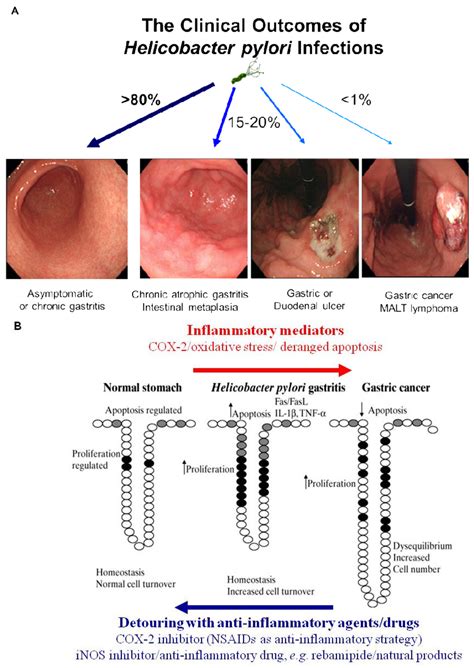 H Pylori Treatment ไทย