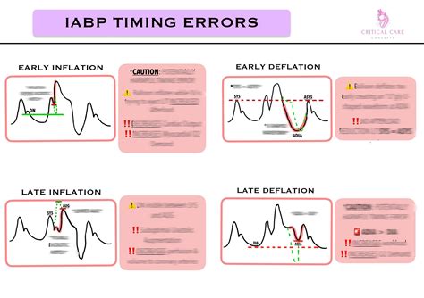 IABP Waveform & Timing Errors ICU Nurse Reference Sheet - Etsy