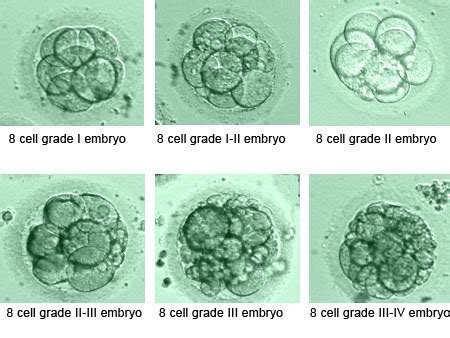 Embryo grading for Day 3 & Day 5 embryos: your questions answered