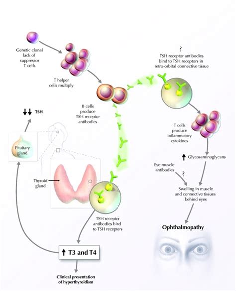 International University: exophthalmos mechanism