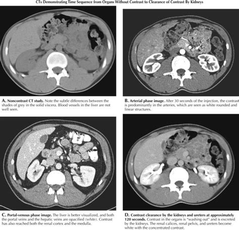 Mri Vs Ct Scan Abdomen