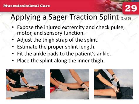 PPT - Applying a Hare Traction Splint (3 of 3) PowerPoint Presentation ...