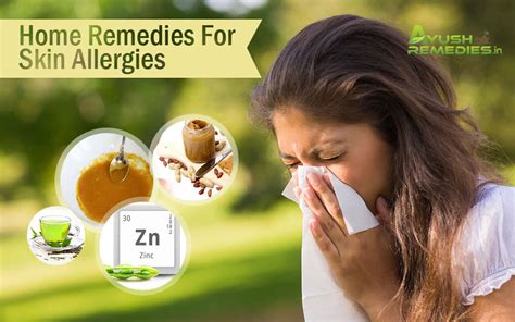 7 Best Home Remedies for Skin Allergies - Get Marvellous Results!