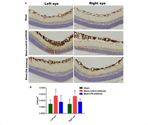 | GFAP immunohistochemistry in the retina sections of both eyes on day ...