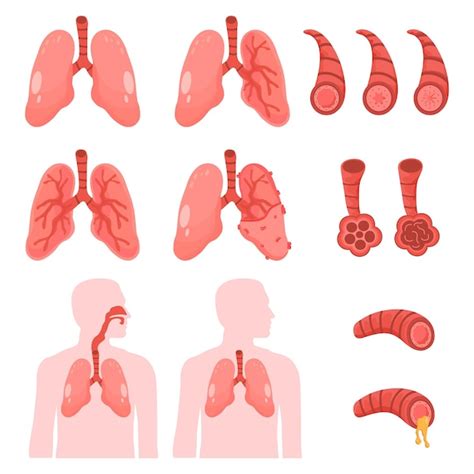 Premium Vector | Human lungs vector clip art icon copd vector ...