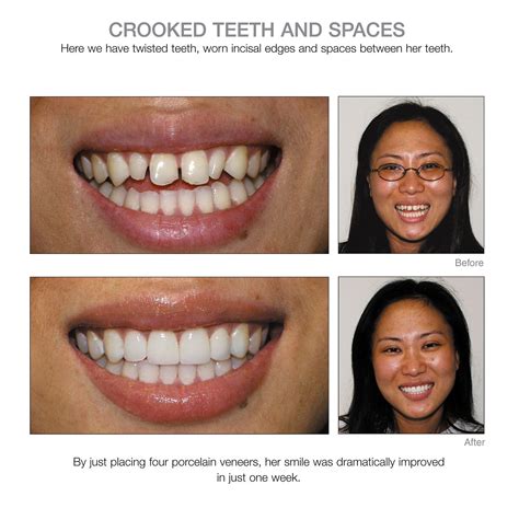 Kurpis Center For Implant and Cosmetic Dentistry | Dental cosmetics ...