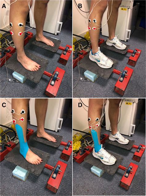 Peroneal Tendonitis Taping