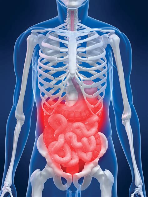 Abdominal Compartment Syndrome EMRA