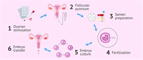 Invitro fertilization process