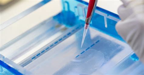 Gel Electrophoresis Explained - Modern Biology Inc