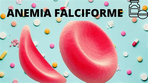 Anemia Falciforme