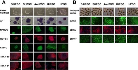 Characterization of induced pluripotent stem cell (iPSC) derived from... | Download Scientific ...