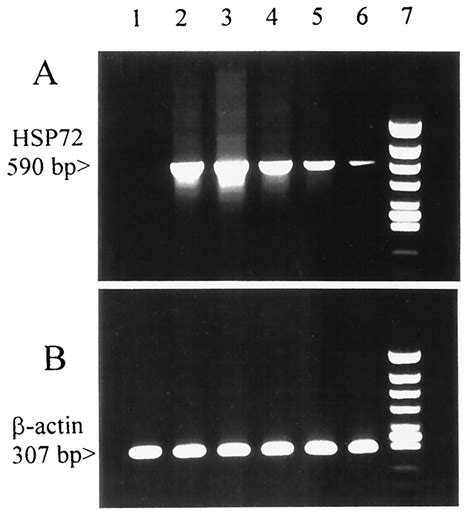 Induction of stress-inducible HSP70 in monocytes after heat shock. (A)... | Download Scientific ...