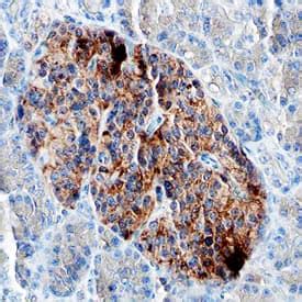 Human Pancreatic Polypeptide/PP Antibody MAB62971: R&D Systems