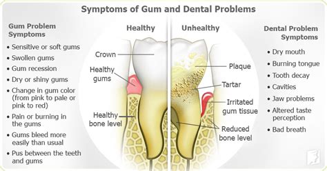 Gum Problems Symptom Information | 34-menopause-symptoms.com