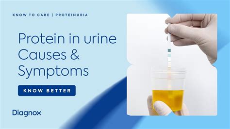 Protein In Urine - Proteinuria | Causes And Symptoms Of Protein In Urine | Diagnox - YouTube