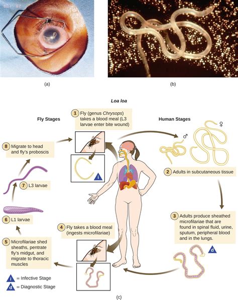 Protozoan and Helminthic Infections of the Skin and Eyes | Microbiology ...