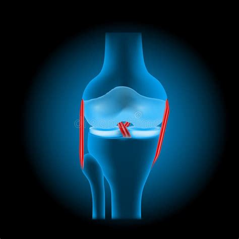 Ligament Injuries To the Knee Joint Stock Vector - Illustration of ...