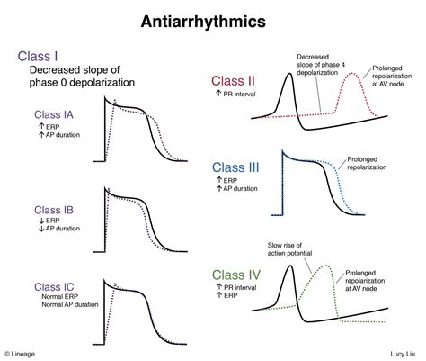 Antiarrhythmics - USMLE Strike