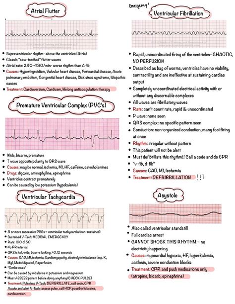 This is a helpful & informative 6 page study guide on EKG dysrhythmias ...