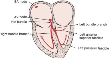 Left Posterior Fascicular Block - Causes, Treatment, Symptoms