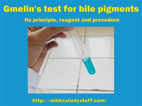 Gmelin's test - Medical Study Zone