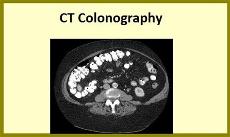 Pin by Dr Peter Thatcher on Irritable Bowel Syndrome | Pinterest