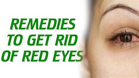 REMEDIES TO GET RID OF RED EYES. | Red eyes remedy, Red eyes, Eye tricks