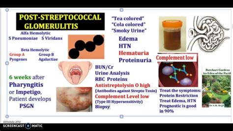 Poststreptococcal Glomerulitis Cause Symptom Diagnosis Treatment ASGN PSGN USMLE NCLEX MCAT 3 ...