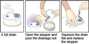 Hemovac Drain Nursing Interventions - Best Drain Photos Primagem.Org