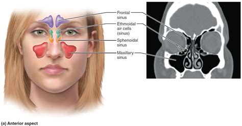 Allergic Fungal Sinusitis - Causes, Symptoms, and Treatment