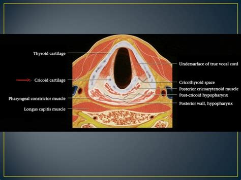 Larynx anatomy ct and mri