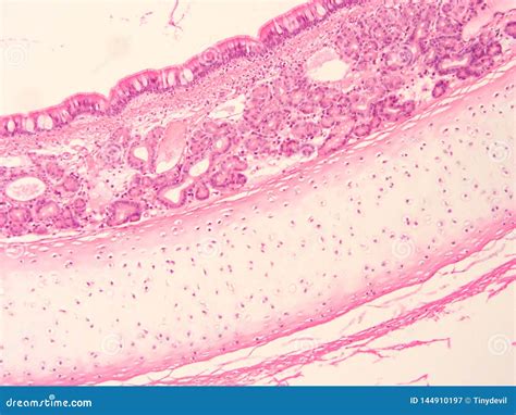 Histology of Trachea Human Tissue Stock Image - Image of microscopic, epithelium: 144910197