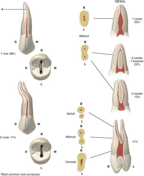 Pulpal anatomy and access preparations | Pocket Dentistry