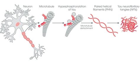 Untangle tau with our guide | Abcam